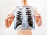 Zapalenie Płuc - Objawy i leczenie